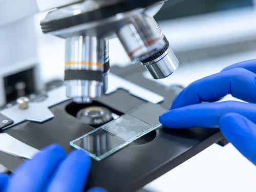 A scientist wearing blue gloves places a glass slide under a powerful microscope lens in a laboratory, conveying precision and scientific focus